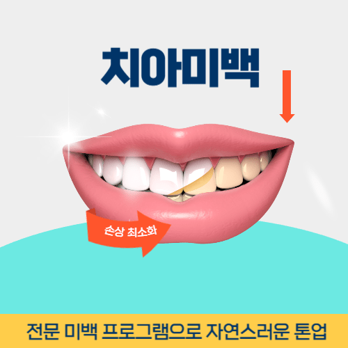 논산치과 논산시 치과 치아미백